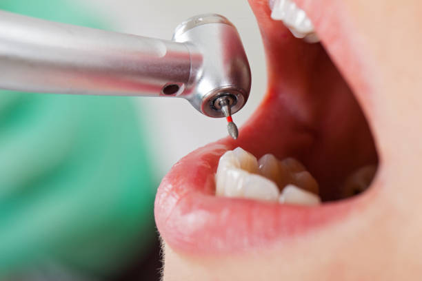 Best After-Hours Emergency Dentist in Athens, TX